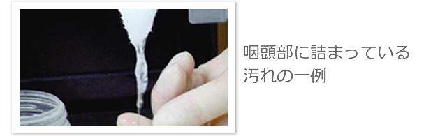 咽頭部に詰まっている汚れの一例